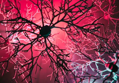 3D image of a neuron cell network with a red glow representing inflammation. 3D image of a neuron cell network with a red glow representing inflammation.